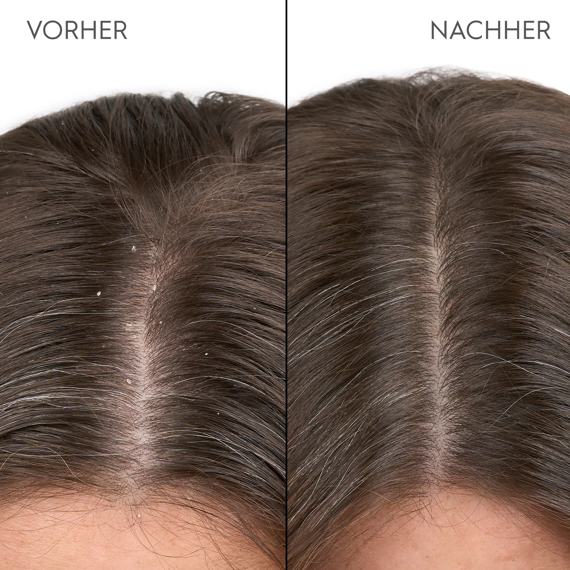 Kerasilk Anti-Schuppen Shampoo