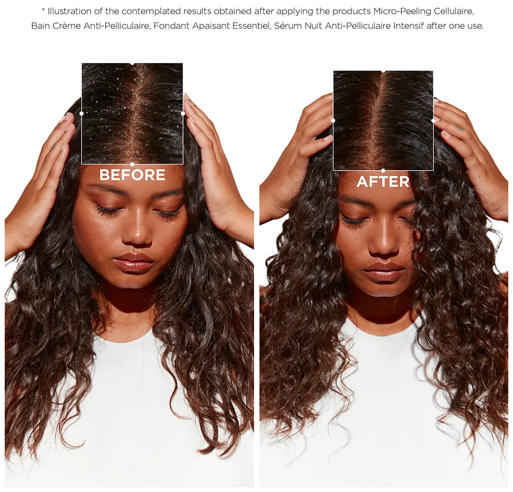 Kérastase Symbiose Bain Crème Anti-Pelliculaire