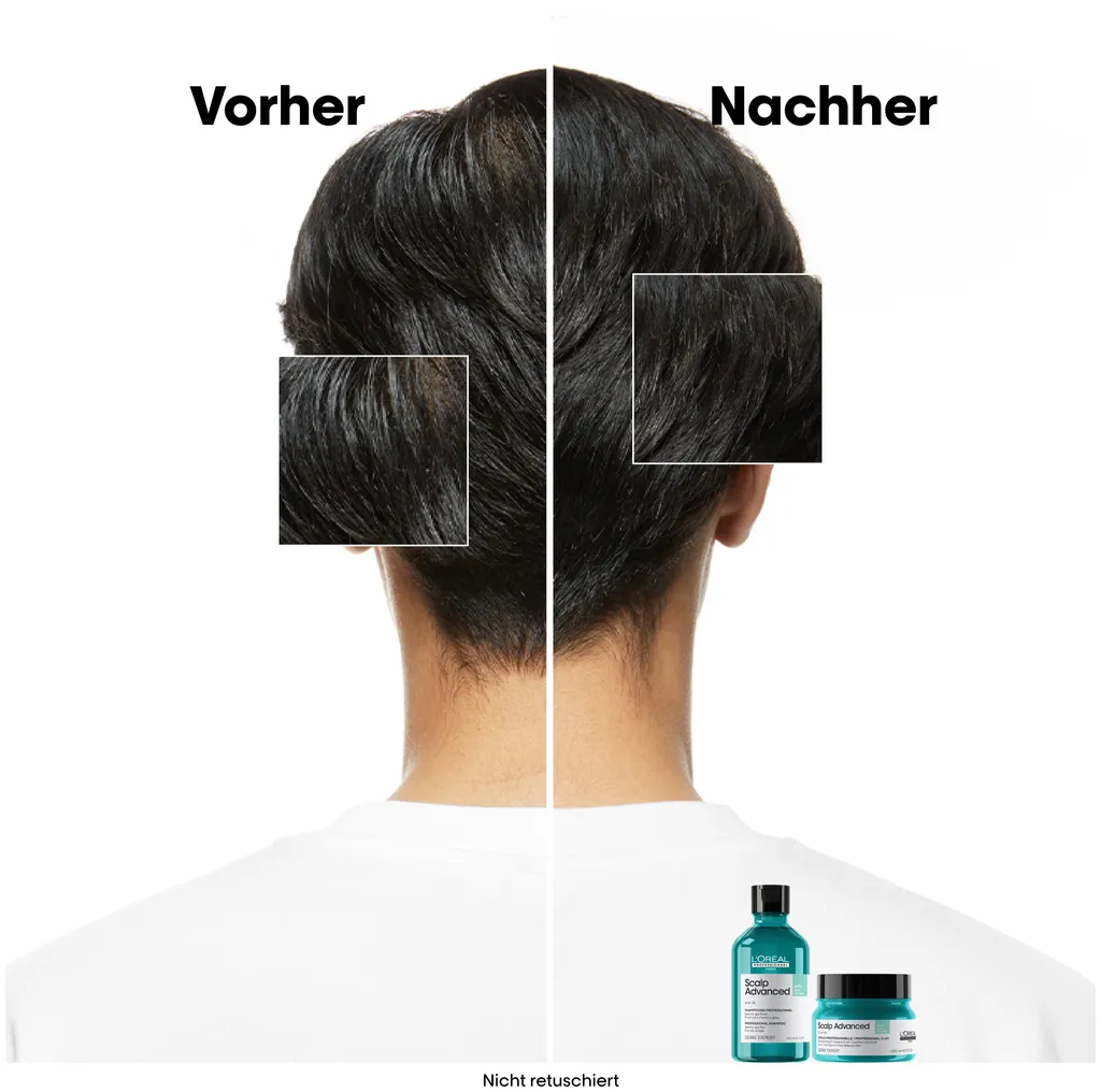 L'Oréal Scalp Advanced Anti-Oiliness 2-in-1 Deep Purifier Clay