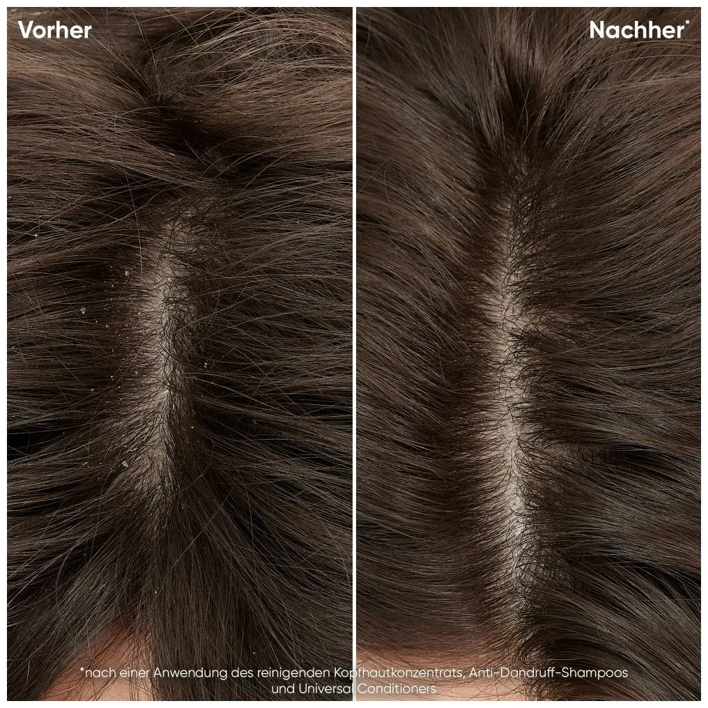 Biolage Scalp Sync Balancing Serum