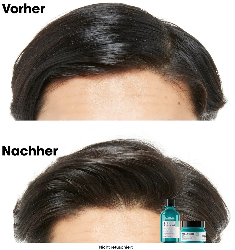 L'Oréal Scalp Advanced Anti-Oiliness 2-in-1 Deep Purifier Clay